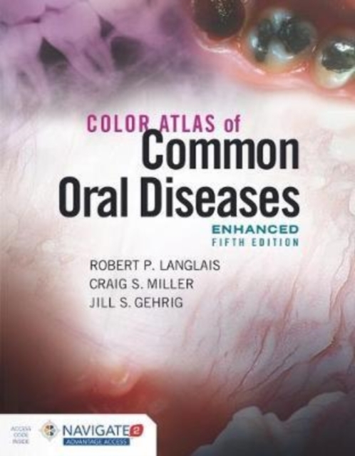 Color Atlas Of Common Oral Diseases, Enhanced Edition, Hardback Book