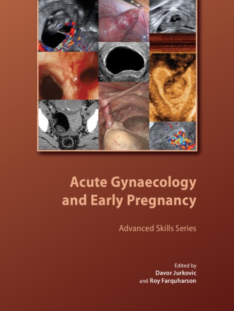 Acute Gynaecology and Early Pregnancy, PDF eBook