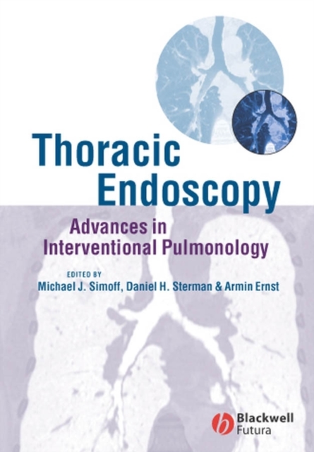 Thoracic Endoscopy : Advances in Interventional Pulmonology, Hardback Book