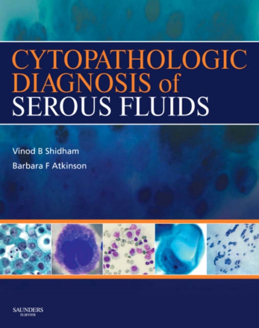 Cytopathologic Diagnosis of Serous Fluids, Hardback Book