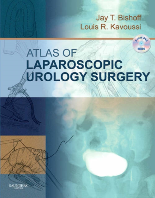 Atlas of Laparoscopic Urologic Surgery, Mixed media product Book