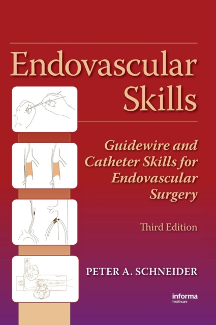 Endovascular Skills : Guidewire and Catheter Skills for Endovascular Surgery, Third Edition, Hardback Book