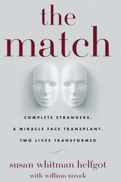 The Match : Complete Strangers, a Miracle Face Transplant, Two Lives Transformed, EPUB eBook