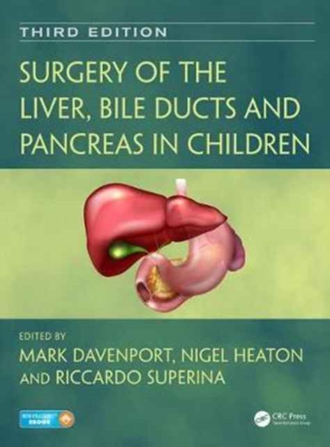 Surgery of the Liver, Bile Ducts and Pancreas in Children, Hardback Book
