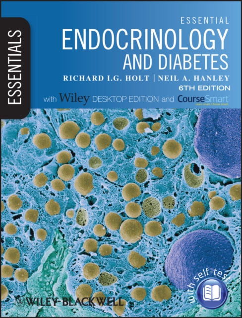 Essential Endocrinology and Diabetes : Includes Desktop Edition, Paperback / softback Book
