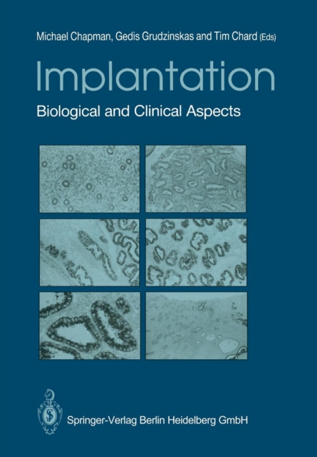 Implantation : Biological and Clinical Aspects, Paperback / softback Book