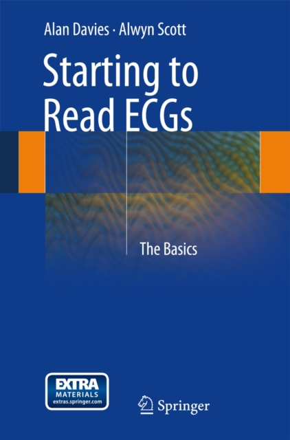 Starting to Read ECGs : The Basics, Paperback / softback Book