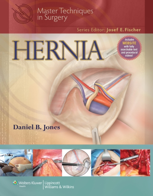 Master Techniques in Surgery: Hernia, Hardback Book