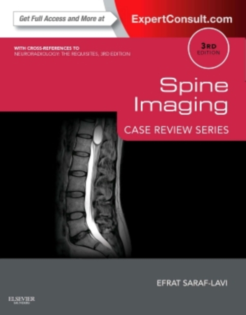 Spine Imaging: Case Review Series : Expert Consult - Online and Print, Paperback / softback Book