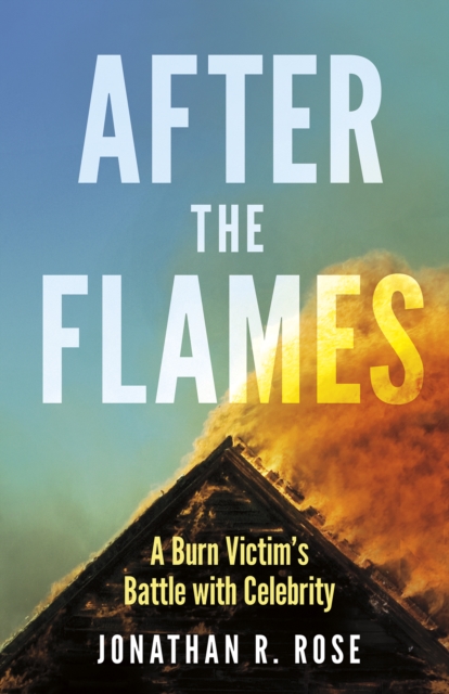 After the Flames : A Burn Victim's Battle With Celebrity, Paperback / softback Book