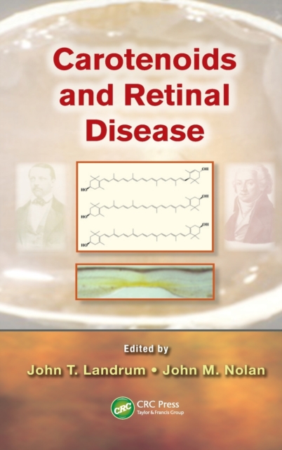 Carotenoids and Retinal Disease, Hardback Book