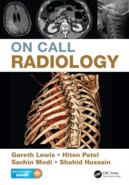 On Call Radiology, Paperback / softback Book