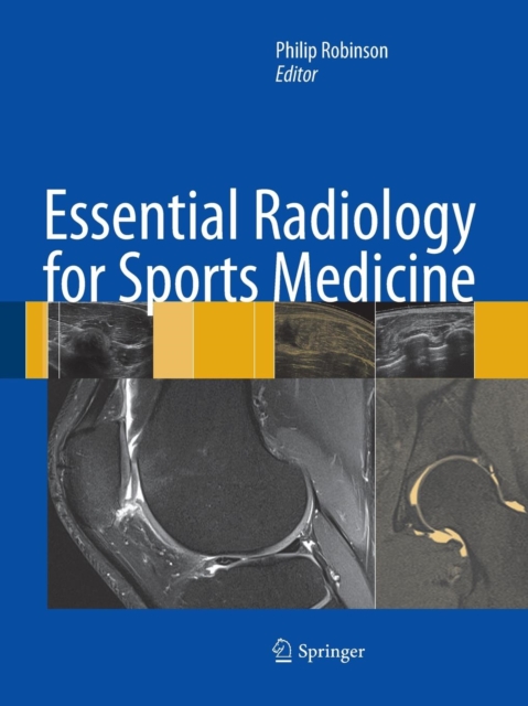 Essential Radiology for Sports Medicine, Paperback / softback Book