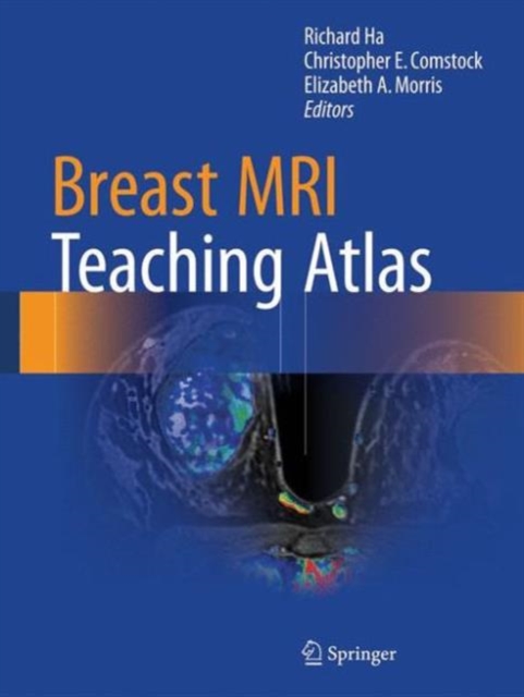 Breast MRI Teaching Atlas, Hardback Book