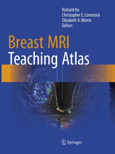 Breast MRI Teaching Atlas, Paperback / softback Book