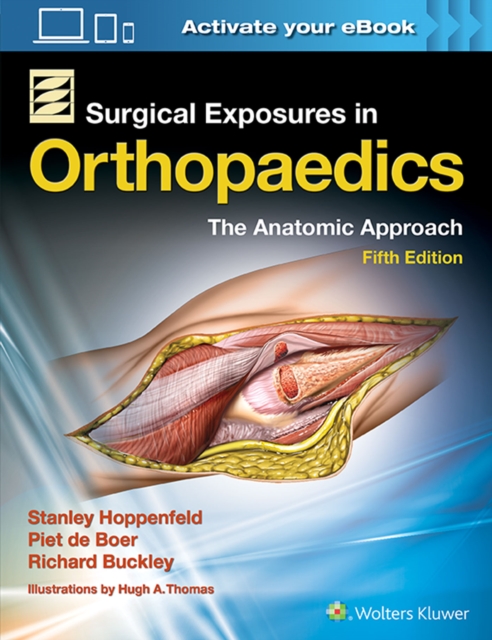 Surgical Exposures in Orthopaedics: The Anatomic Approach, Hardback Book