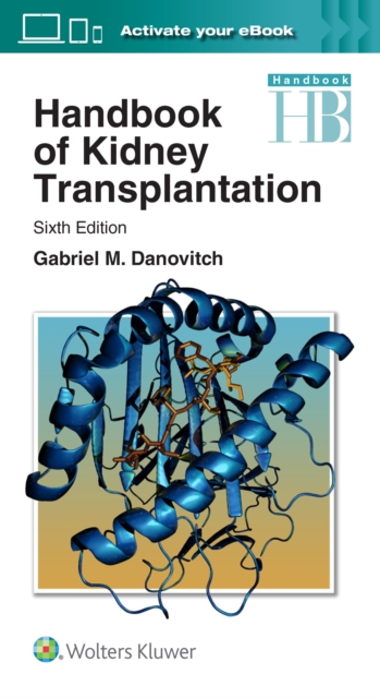 Handbook of Kidney Transplantation, Paperback / softback Book