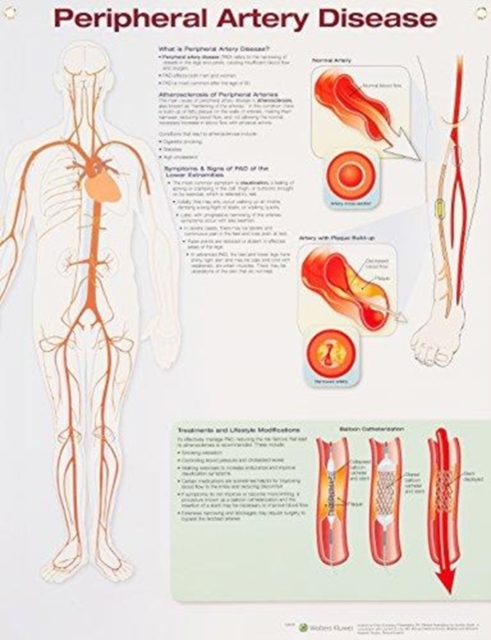Peripheral Artery Disease, Poster Book