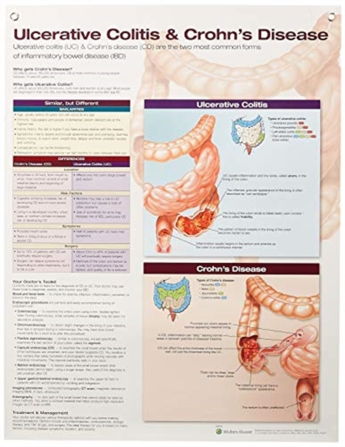 Ulcerative Colitis & Crohn's Disease Anatomical Chart Laminated, Poster Book