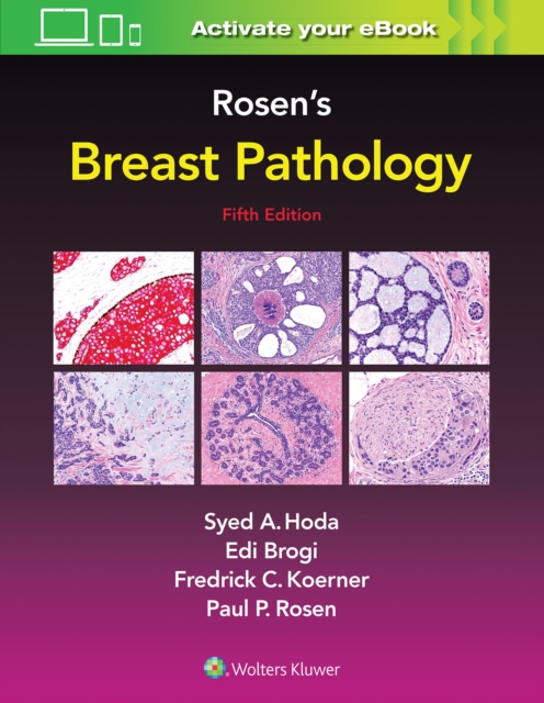 Rosen's Breast Pathology, Hardback Book