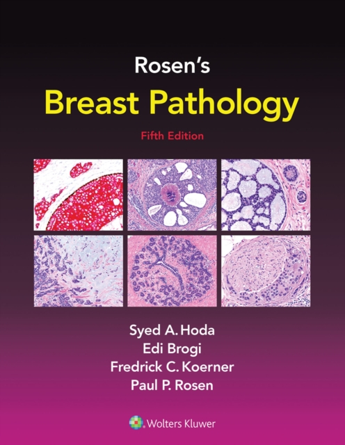Rosen's Breast Pathology, EPUB eBook