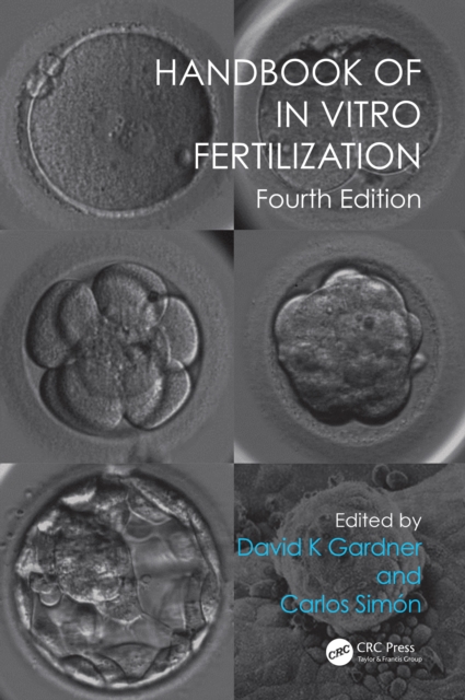 Handbook of In Vitro Fertilization, EPUB eBook