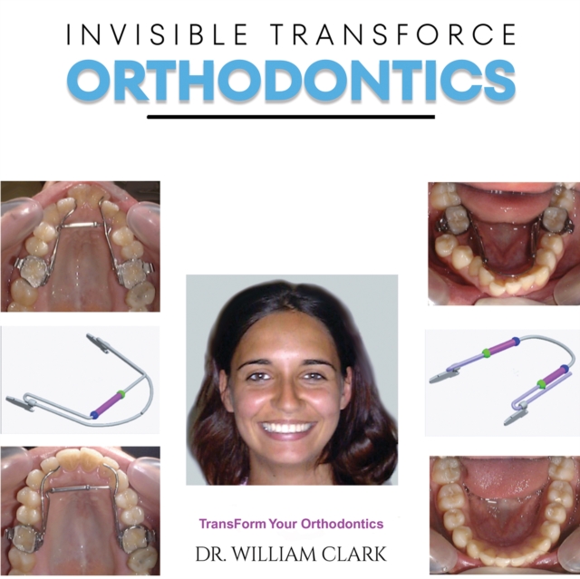 Invisible TransForce Orthodontics, Paperback / softback Book