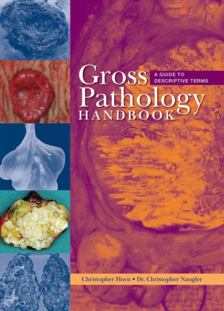 Gross Pathology Handbook : A Guide to Descriptive Terms, Spiral bound Book