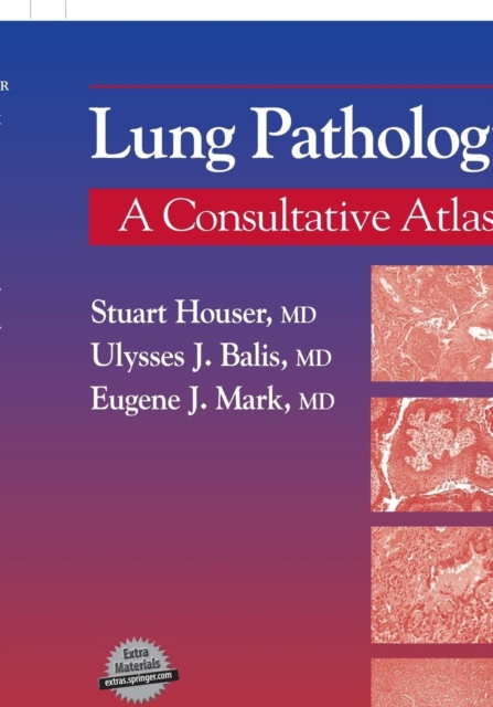 Lung Pathology, Multiple-component retail product Book