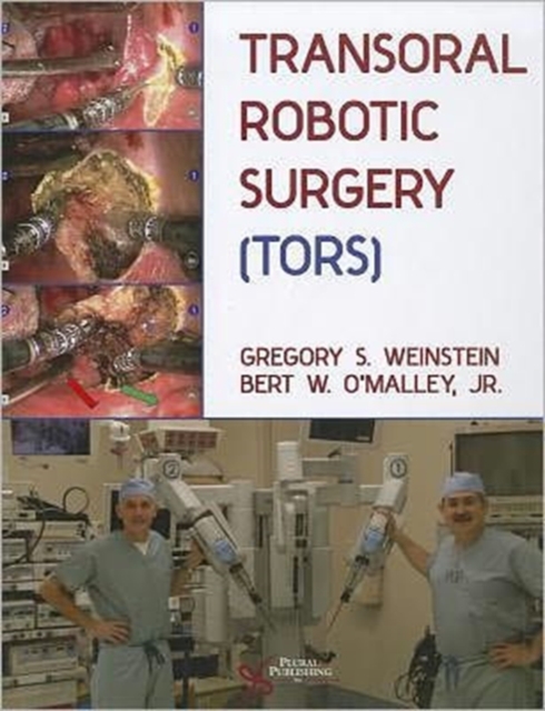 Transoral Robotic Surgery (TORS), Hardback Book