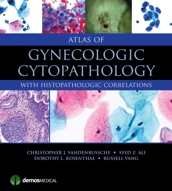Atlas of Gynecologic Cytopathology : with Histopathologic Correlations, Hardback Book