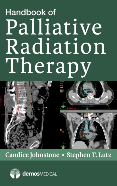 Handbook of Palliative Radiation Therapy, Paperback / softback Book