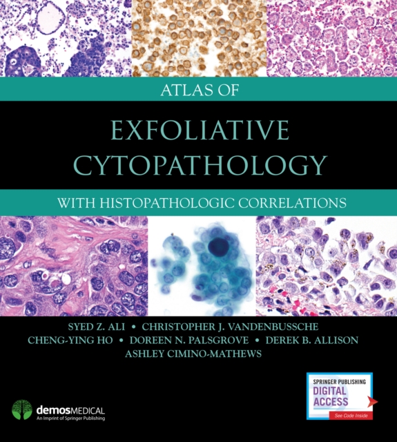 Atlas of Exfoliative Cytopathology : With Histopathologic Correlations, Hardback Book