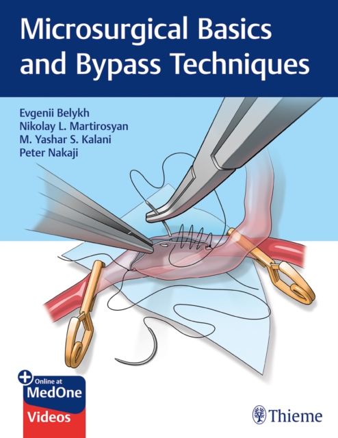 Microsurgical Basics and Bypass Techniques, Mixed media product Book