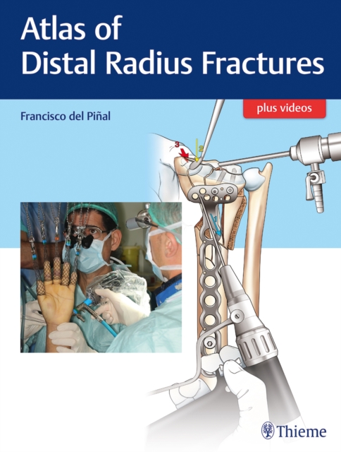 Atlas of Distal Radius Fractures, Multiple-component retail product, part(s) enclose Book