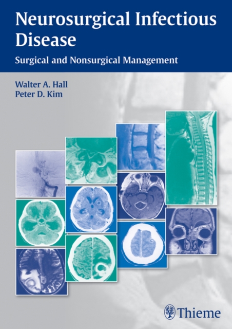 Neurosurgical Infectious Disease : Surgical and Nonsurgical Management, EPUB eBook
