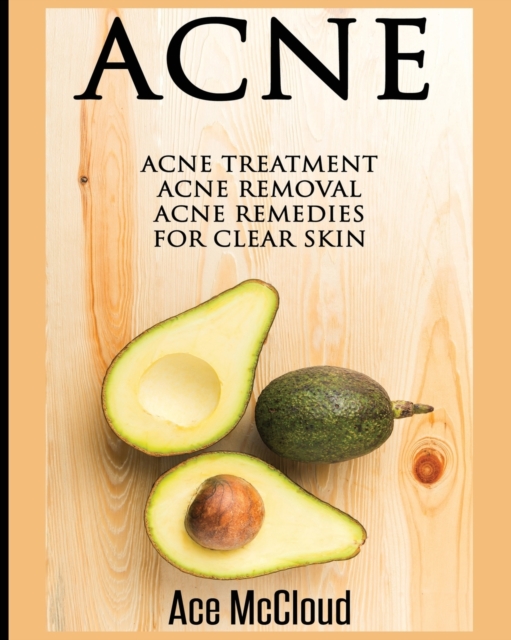 Acne : Acne Treatment: Acne Removal: Acne Remedies for Clear Skin, Paperback / softback Book