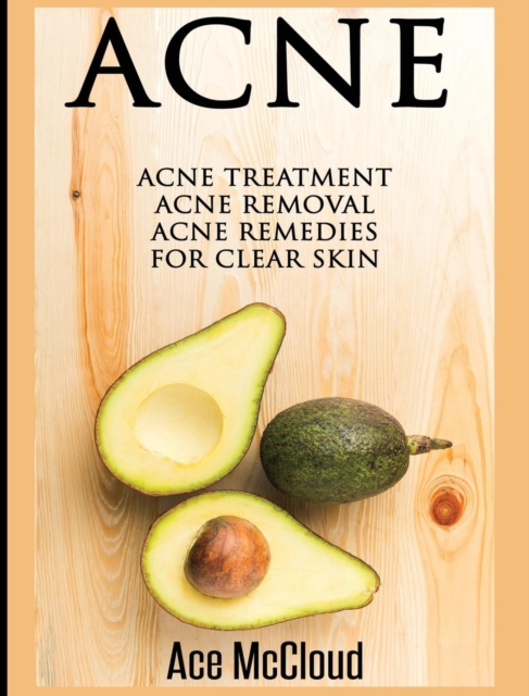 Acne : Acne Treatment: Acne Removal: Acne Remedies for Clear Skin, Hardback Book
