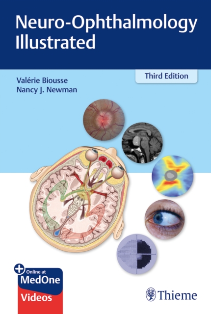 Neuro-Ophthalmology Illustrated, Multiple-component retail product, part(s) enclose Book