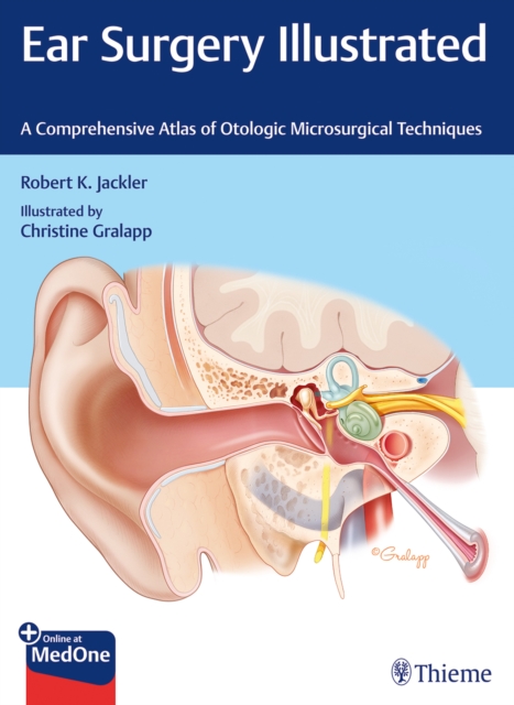 Ear Surgery Illustrated : A Comprehensive Atlas of Otologic Microsurgical Techniques, Hardback Book