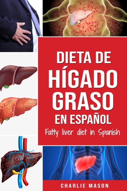 Dieta de higado graso en espanol/Fatty liver diet in Spanish, Paperback / softback Book