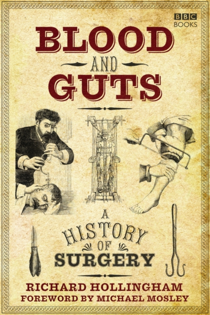 Blood and Guts : A History of Surgery, Paperback / softback Book