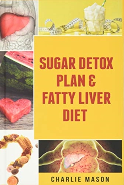 Sugar Detox Plan & Fatty Liver Diet Books : Fatty Liver Disease, Hardback Book