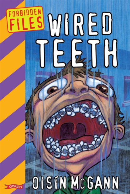 Wired Teeth, EPUB eBook
