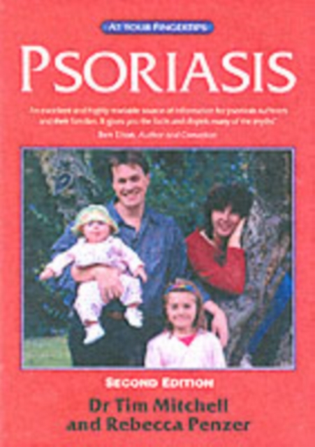Psoriasis 2e : At Your Fingertips, Paperback / softback Book