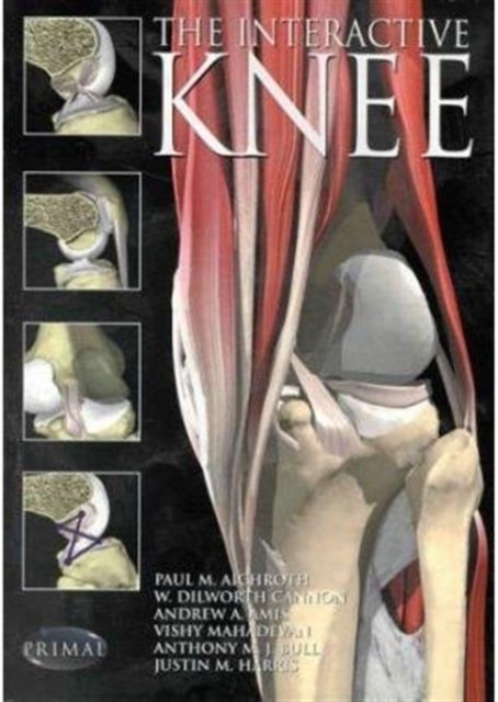 Interactive Knee, CD-ROM Book