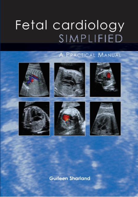 Fetal Cardiology Simplified : A Practical Manual, Paperback / softback Book