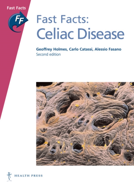 Fast Facts: Celiac Disease, Paperback / softback Book