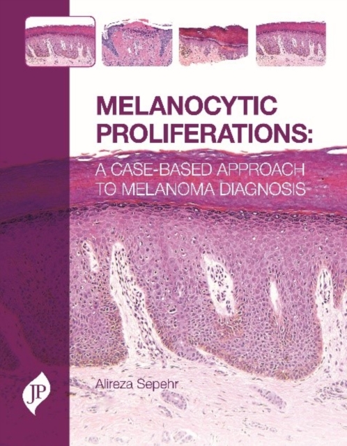 Melanocytic Proliferations : A Case-Based Approach to Melanoma Diagnosis, Hardback Book