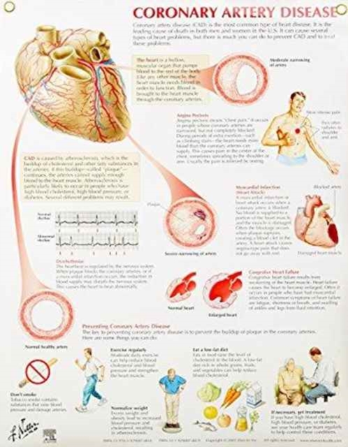 Coronary Artery Disease Chart, Poster Book